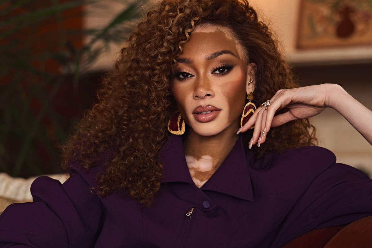 Winnie Harlow Vitiligo