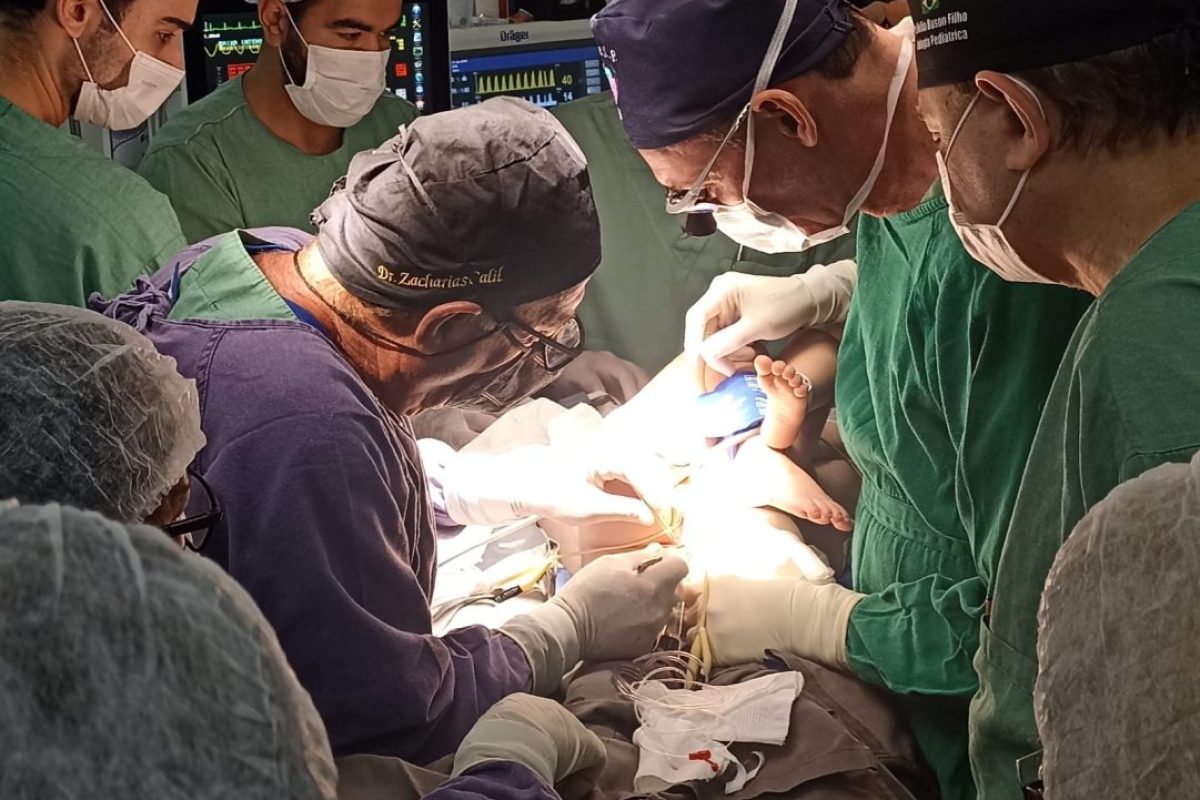 Gemeas-siamesas-sao-separadas-em-Goiania-1-1